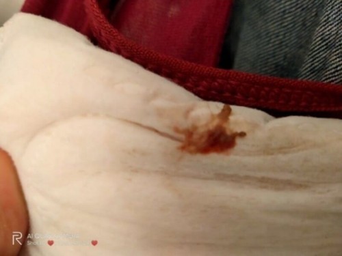 Keluar ketulan darah selepas hubungan intim