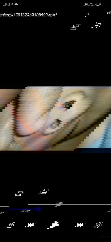 SINO PO MAY ALAM NITO? 
NASAL POLYPS po ba ang tawag dito?