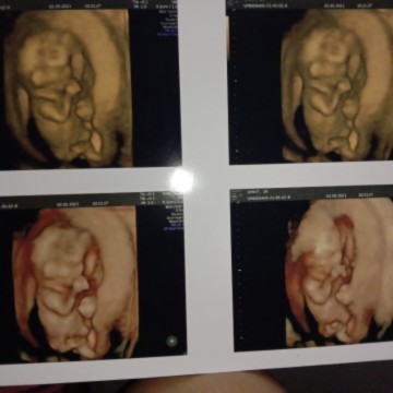 Sehat" ya kesayangannya mama 😘