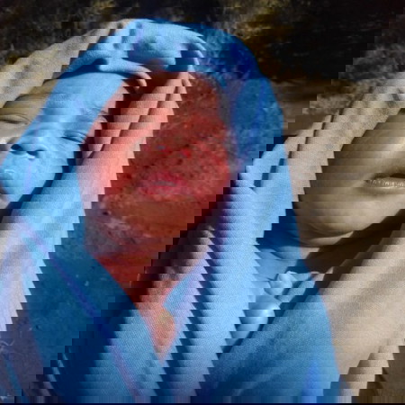 cek pertumbuhan bayi