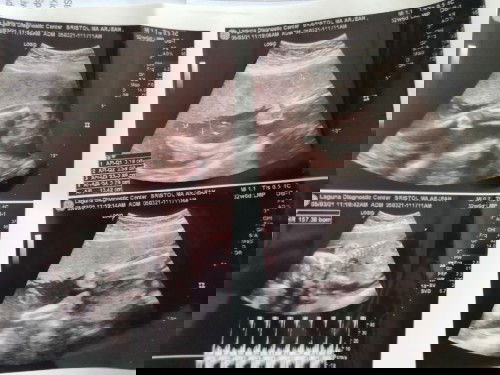 2nd time ultrasound 😭