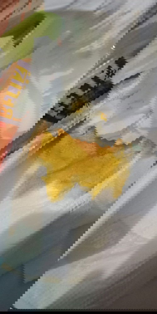 Poop (bab) bayi 18 hari