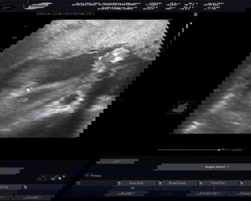 ทีม1สิงหาคม