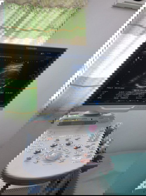 สอบถามหน่อยค่ะ แม่ๆบ้านไหน รู้จักข้อมูลในจอคอม บอกหน่อยค่ะ