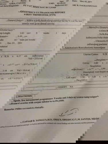 Okay po ba trans v ko?