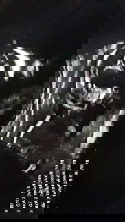 รูปอัลตร้าซาว