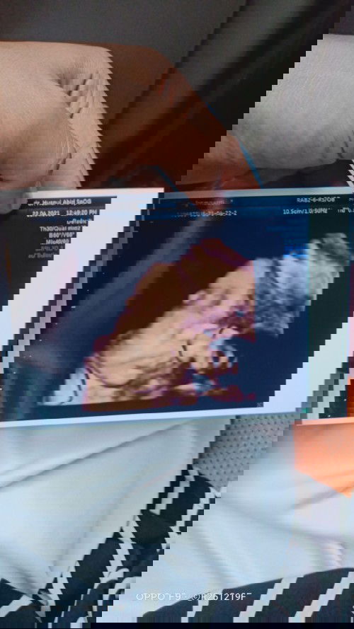 Kiat2 agara cepat kontraksi