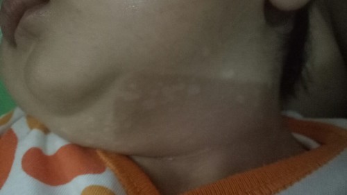 kulit bayi