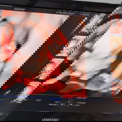 เด็กดิ้นเก่ง