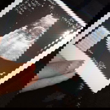 Beda dr itungan bidan