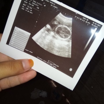 Beda dr itungan bidan