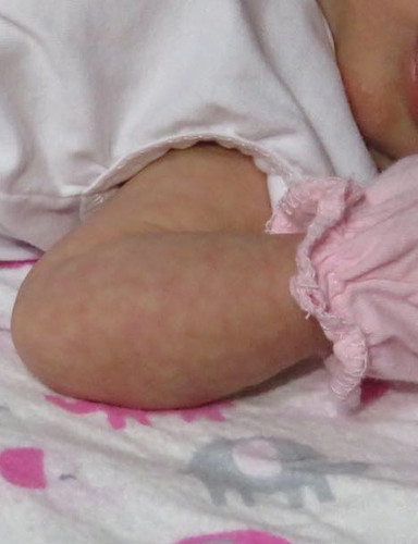 NEWBORN SKIN