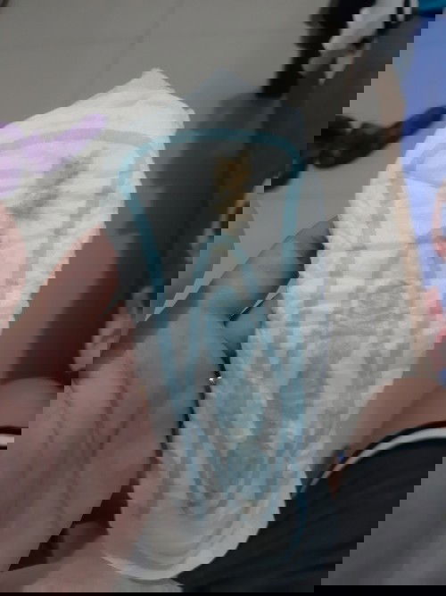 Light brown discharge