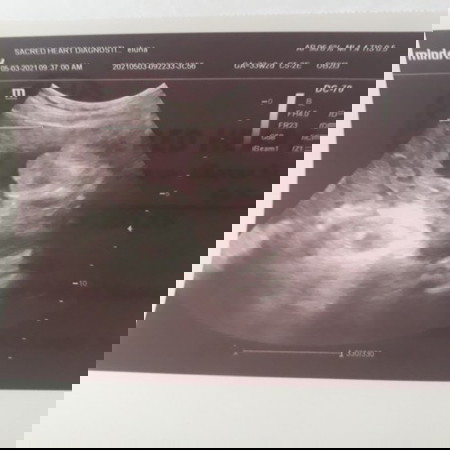 Share, kulang ultrasound ko kahapon mga momsh π€
Plss namn pa advise/suggest π
-thankyou π