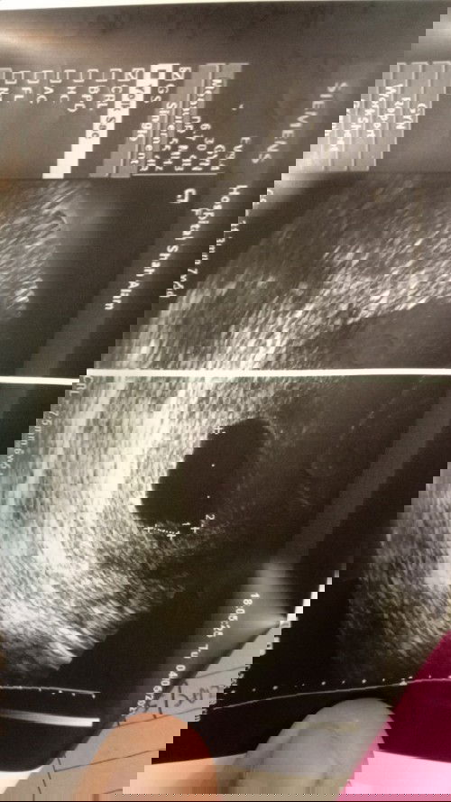 2 minggu lg dokter suruh cuci..sbb dh 11 minggu 3 hari nmpk kantung ja..😭😭