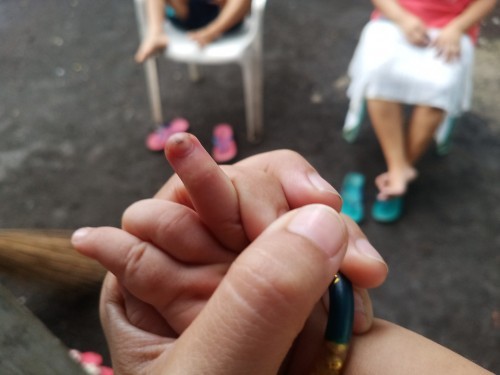anu po kaya mabisang gamot sa kuko ng baby ko namamaga po at may nana plss help 🙏🙏🙏
