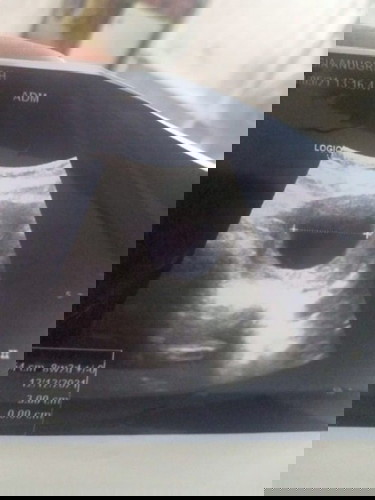 😥 hamil kosong 😭