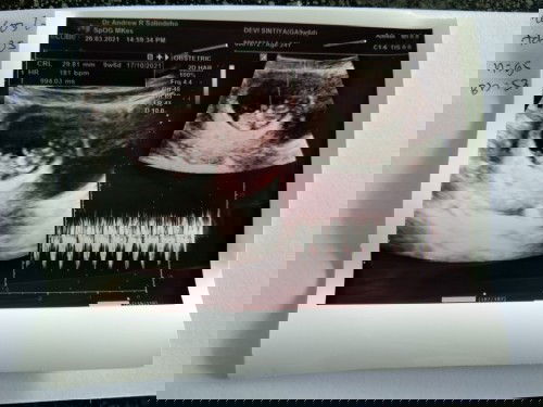 Alhamdulilah ini usia waktu 9mgg 6hr,skrg udh 16mgg 3hr❤️ada yg sama ga moms? 🤗