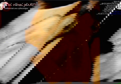 Posisi janin 31w kaki ke atas sebelah menutup muka