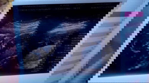 บันทึกลูกรัก 18วีค❤️