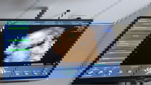 บันทึกลูกรัก 22วีค