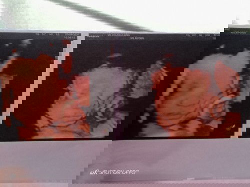 แม่ๆธีม#กรกฎาคมรางงานตัวกันหน่อยค่ะ น้องกับหัวกันหรือหยังค่ะแม่บ้านนี้หยังไม่รู้เลย