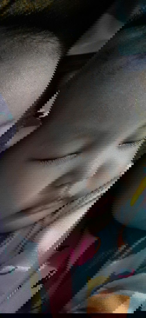 Biang keringat ato gabaken (campak)