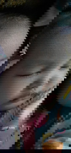 Biang keringat ato gabaken (campak)