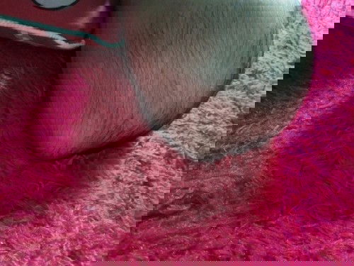 Benjolan dikepala bayi