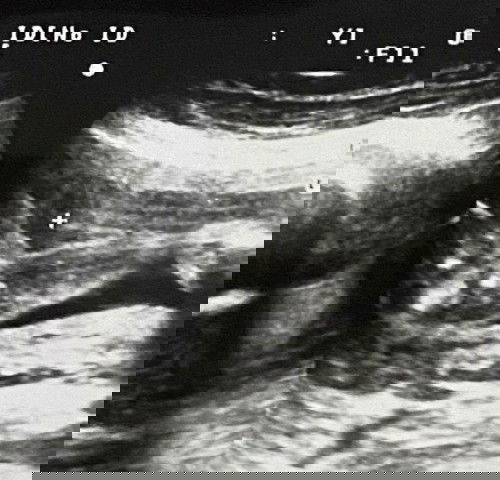 แบบนี้ ช/ญ คะ?