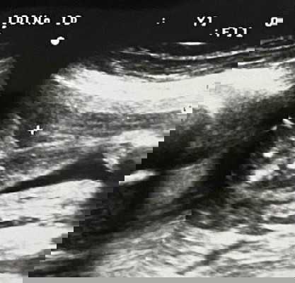 แบบนี้ ช/ญ คะ?