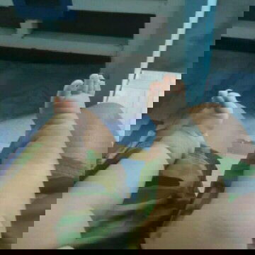 Pahelp po for my Clubfoot baby