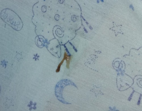 Hamil atau tanda haid atau keguguran?