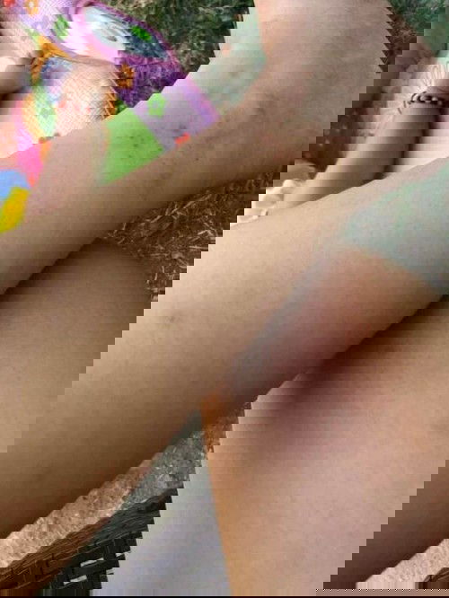 Sugat sa legs at sa paa..