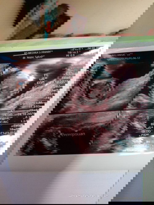 Bantu baca hasil usg