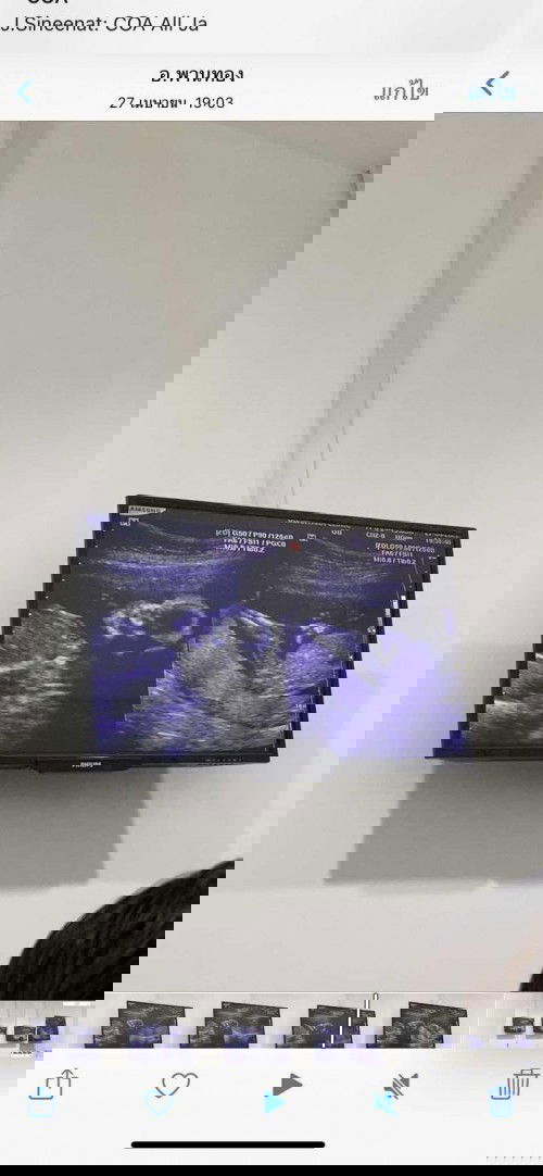 18 week 4 day ต้าวเบบี๋ ลูกสาวคนเก่งของแม่กะพ่อ #ลูกคนแรก #ลูกสาว  👼