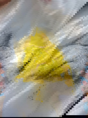 ท้องเสียหรือป่าวแบบนี้