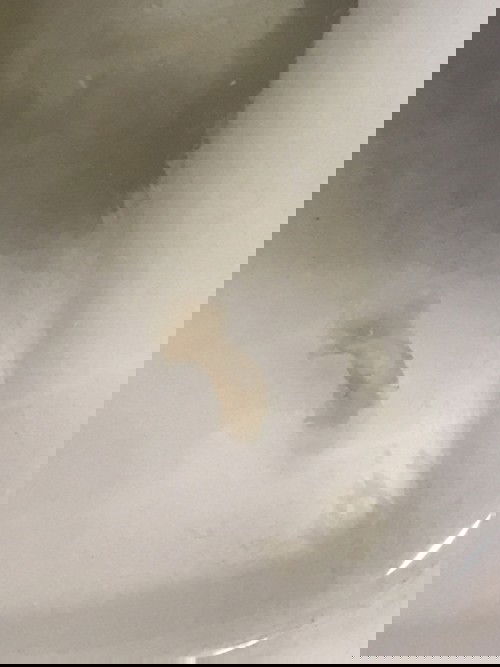 ตั้งครรถ์ 9 สัปดาห์ มีเหมือนเมือกเยื่อไสีน้ำตาลหน่อยๆออกมา จะเป็นอะไรมั้ยคะ