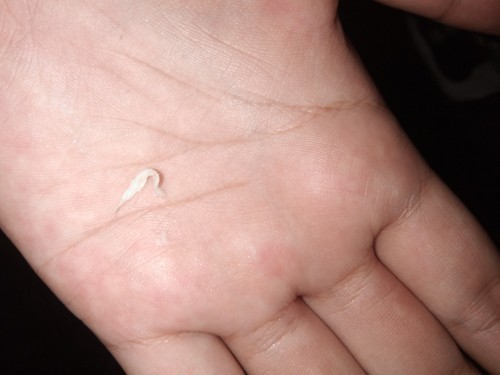 มูกหรือตกขาว