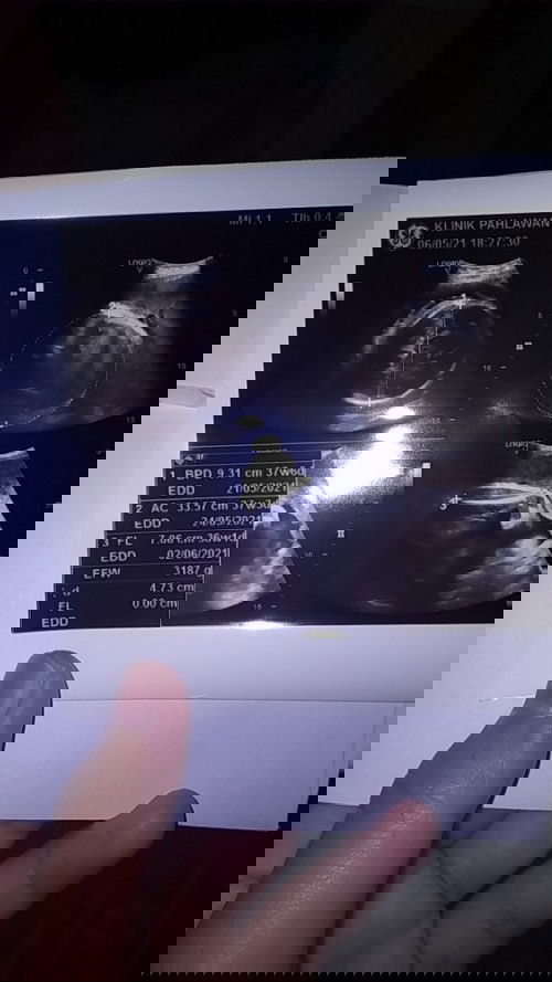 Menunggu gelombang cinta