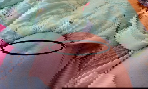 แบบนี้คือท้องแข็ง หรือมดลูกลอยคะ