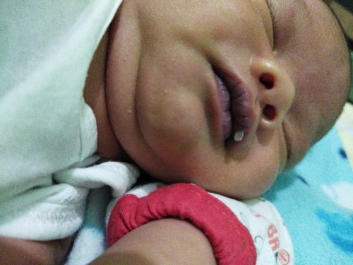 Dry lips for newborn