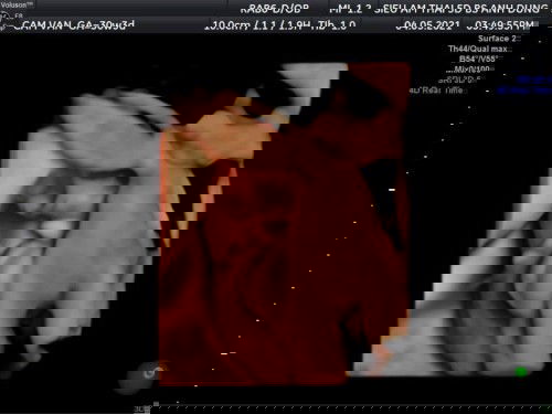 Gạo 👶🏻 30w4d -1kg8