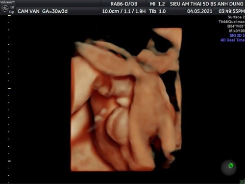 Gạo 👶🏻 30w4d -1kg8