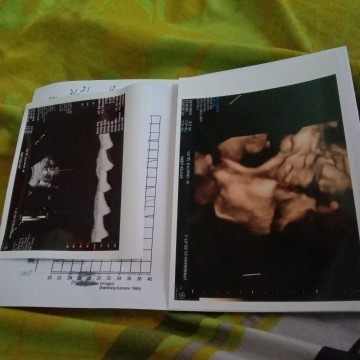 hamil 35 weeks