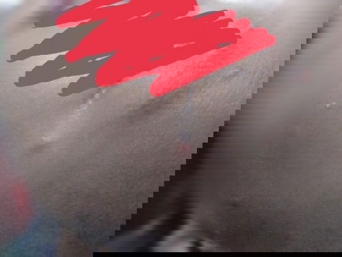 Bentol merah di wajah gak kunjung hilang