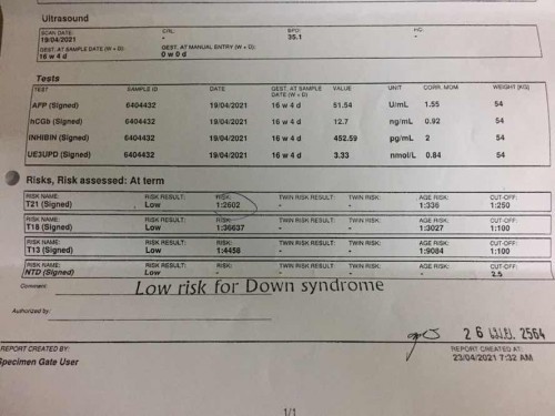ดาวซินโดรม ผลออกมาแล้วความเสี่ยงต่ำ