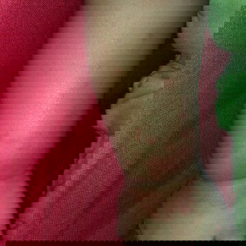 Merah merah ditangan