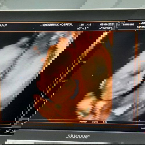 35wks อีกนิดเดียว boy