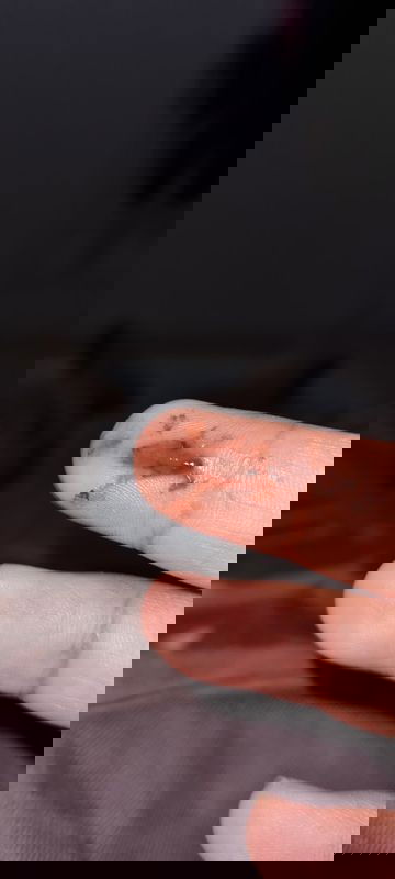 Flek coklat tua usia janin 11 minggu